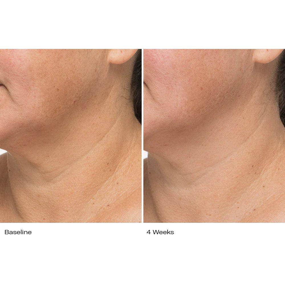 Before and after results of Plumbody Plum Oil Body Cream on neck skin showing improved texture and reduced wrinkles after 4 weeks