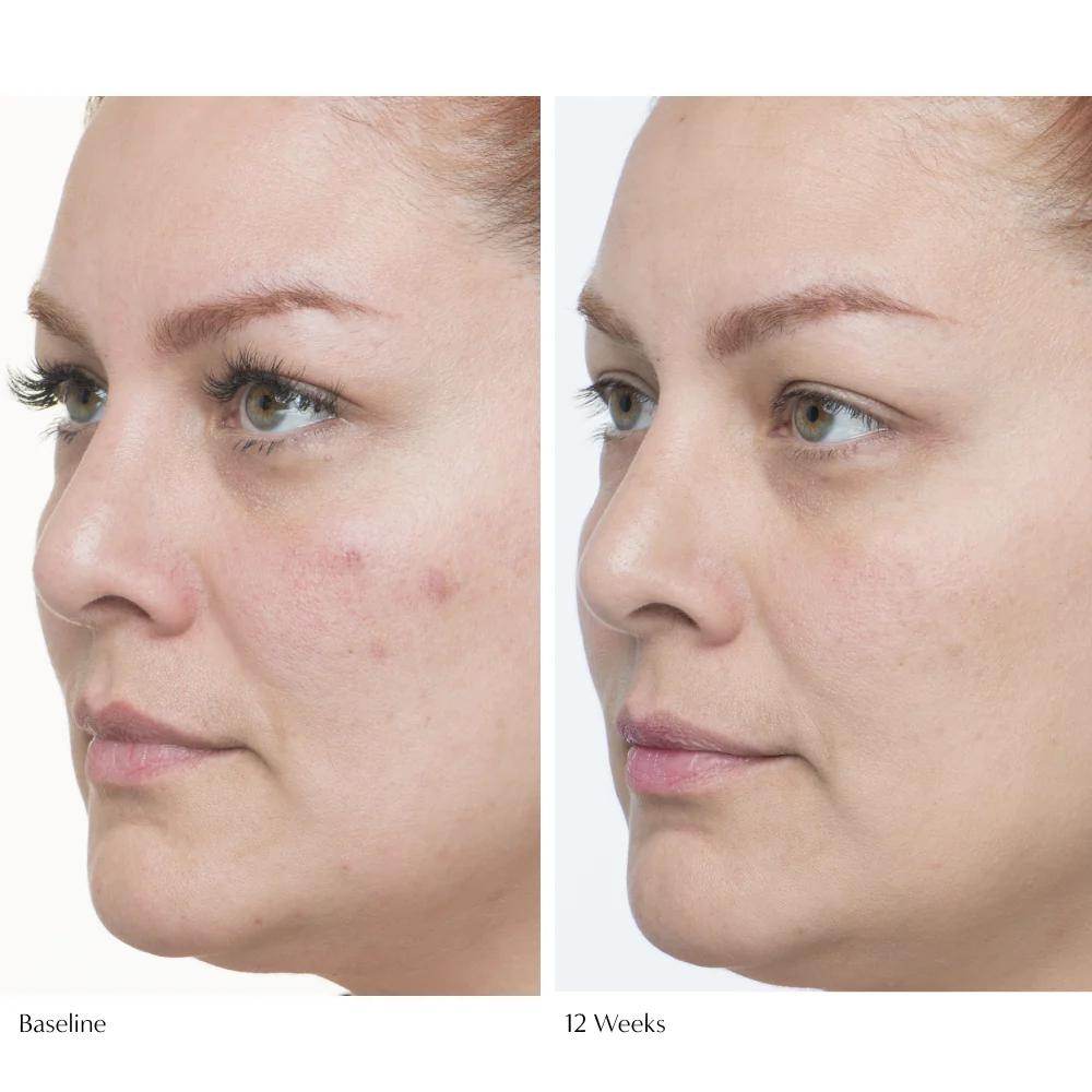 Plumscreen Broad Spectrum SPF 31 - London Beauty