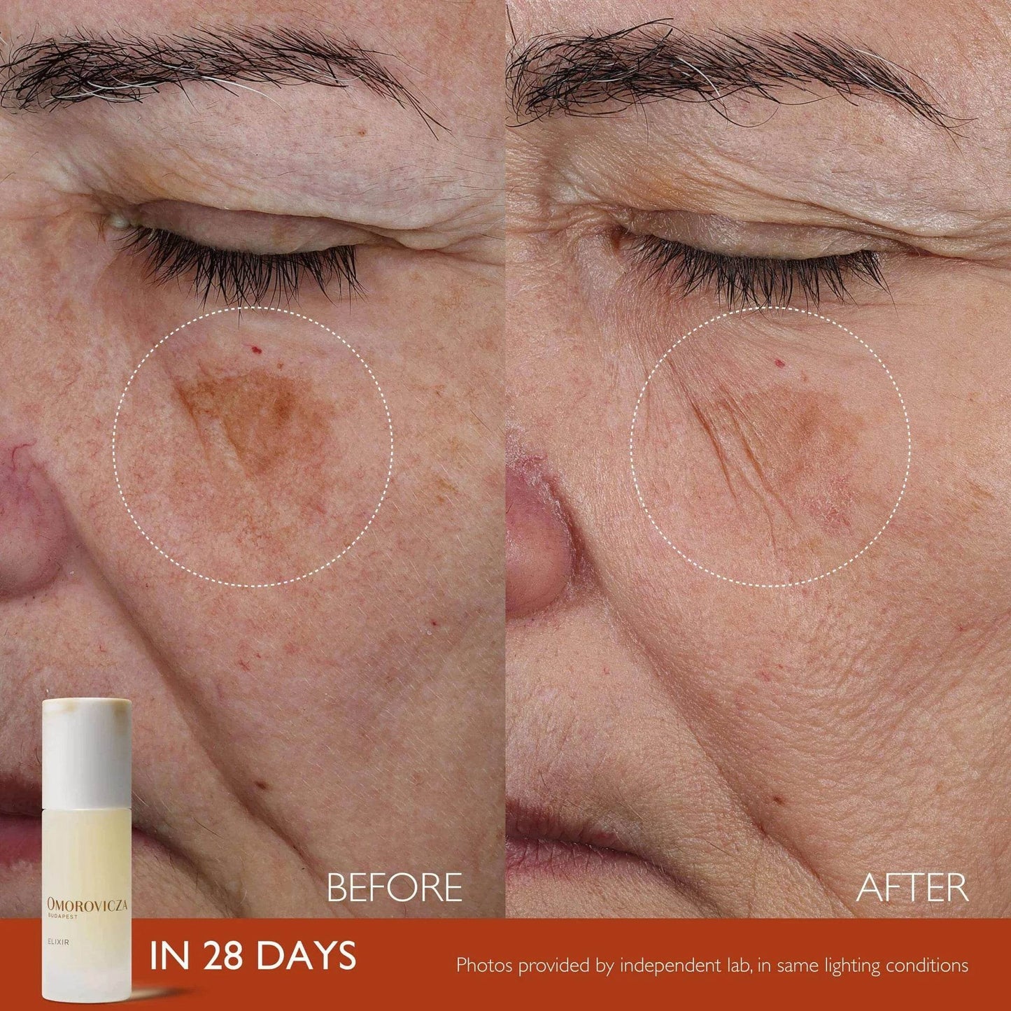 Elixir Active Serum - London Beauty