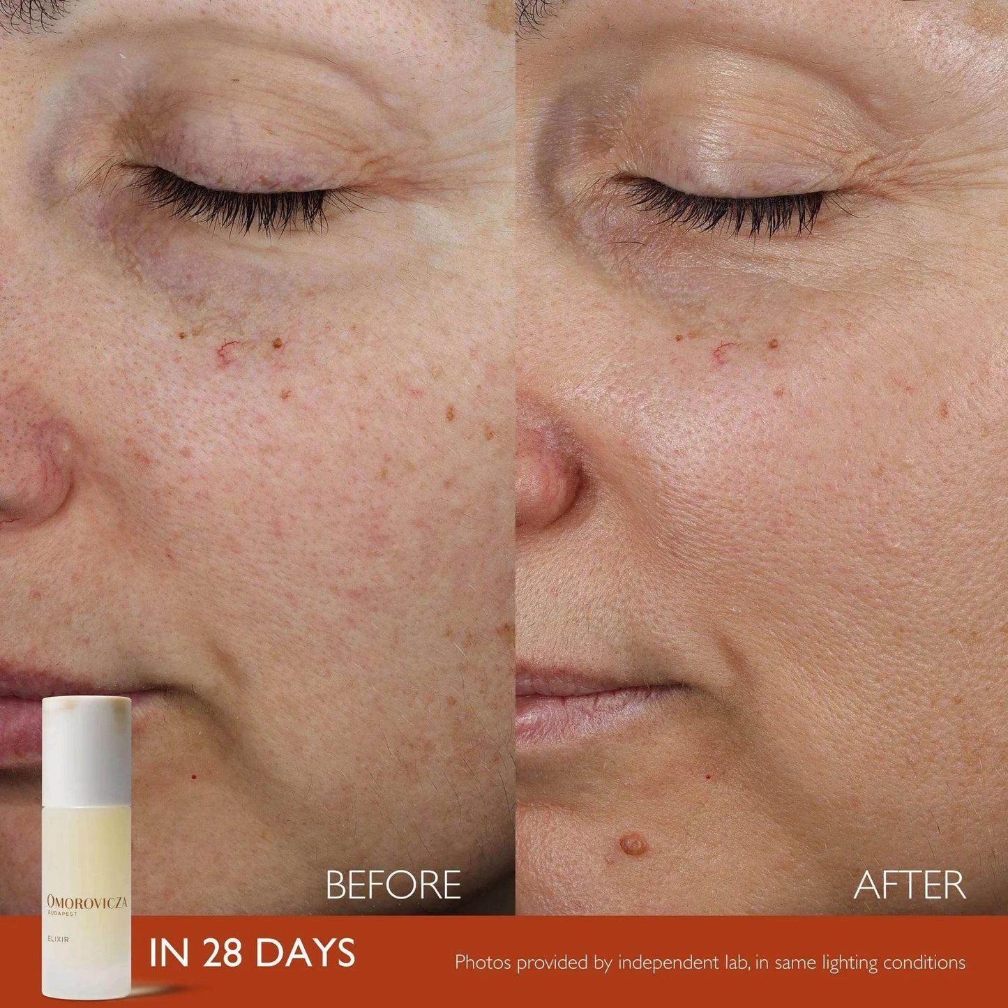 Elixir Active Serum - London Beauty