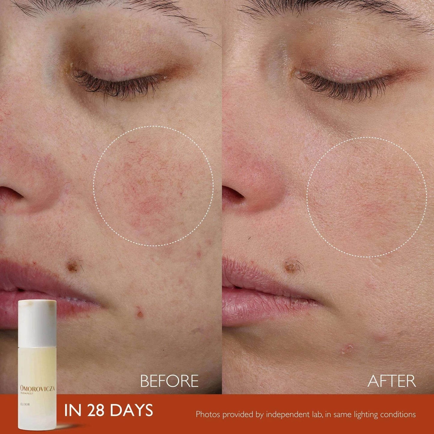 Elixir Active Serum - London Beauty