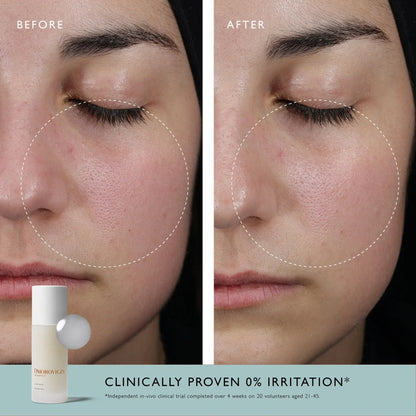 Acid Milk | Resurfacing Essence
