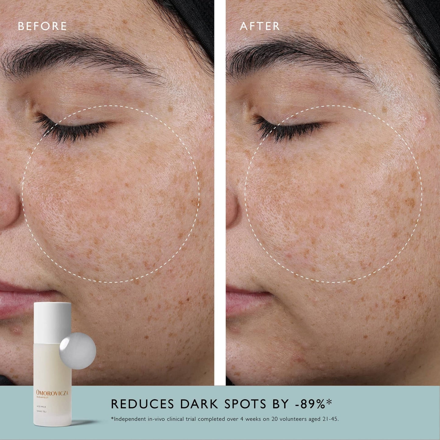 Acid Milk | Resurfacing Essence