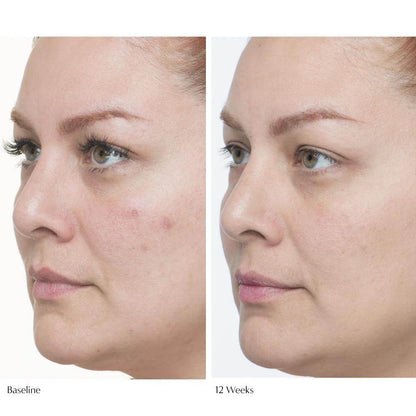 Plumscreen Broad Spectrum SPF 31 - London Beauty