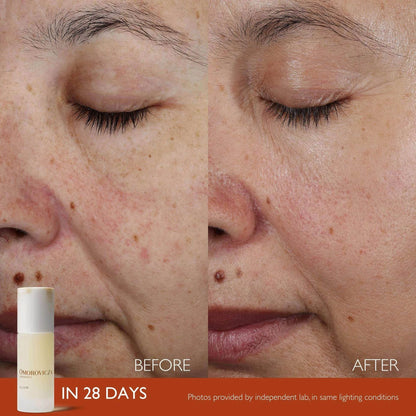 Before and after results of using Omorovicza Active Serum showing improved skin texture in 28 days