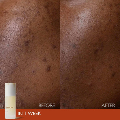 Omorovicza Active Serum Before and After Results Showing Improved Skin Texture and Clarity