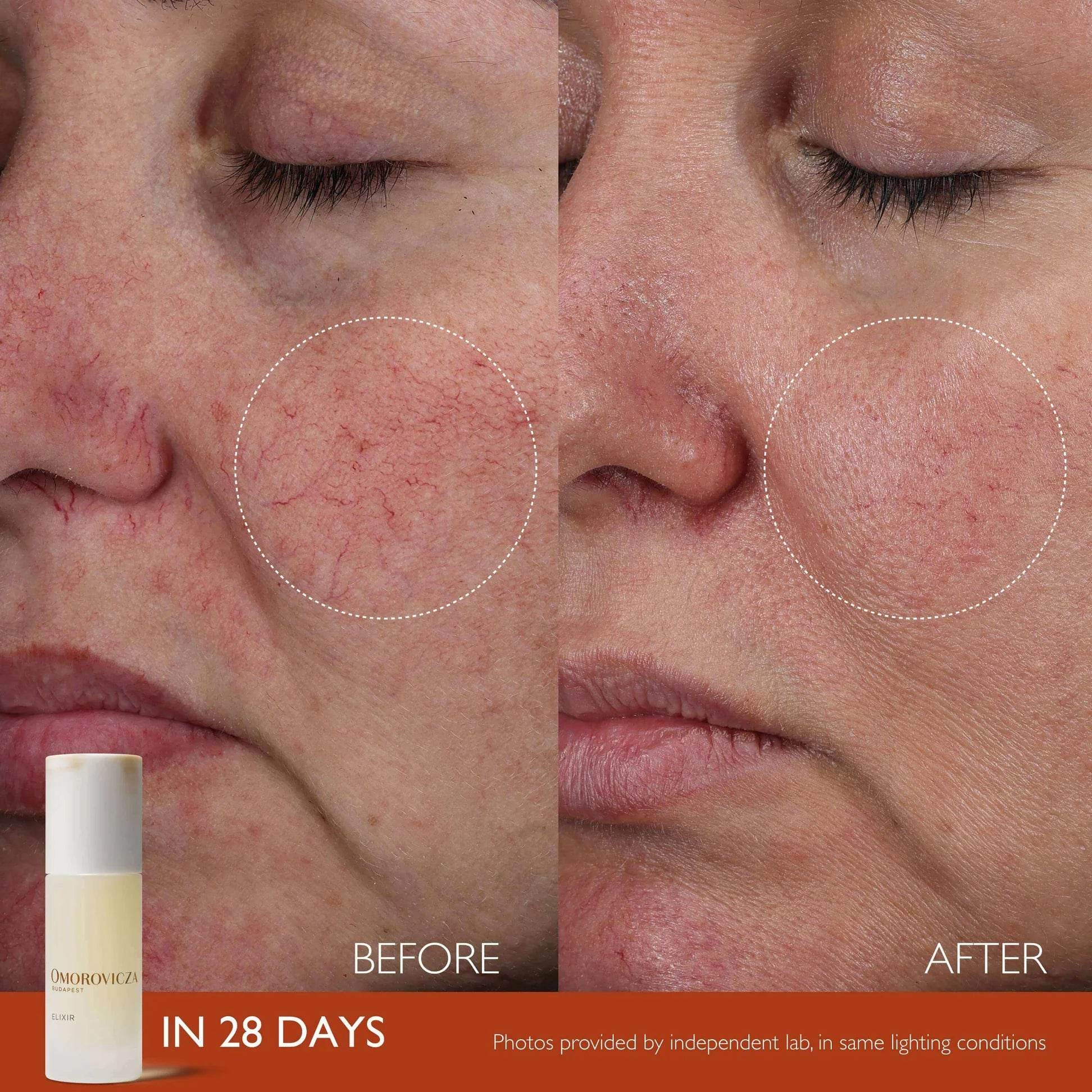 Before and after results of Omorovicza Active Serum showing skin improvement in 28 days