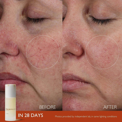 Before and after results of Omorovicza Active Serum showing skin improvement in 28 days