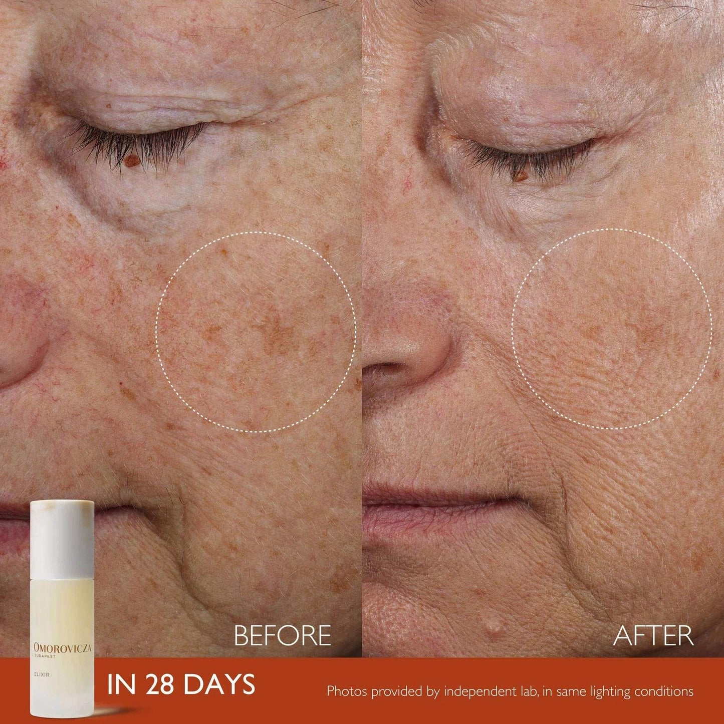 Before and after results of Omorovicza Active Serum showing improved skin texture and reduced pigmentation in 28 days