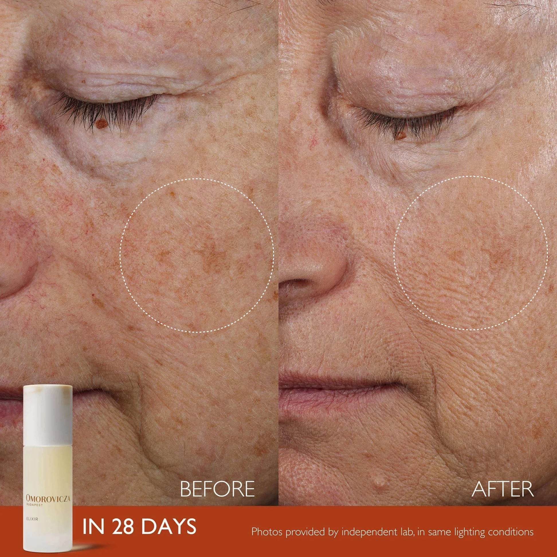 Before and after results of Omorovicza Active Serum showing improved skin texture and reduced pigmentation in 28 days