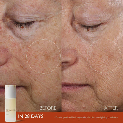 Before and after results of Omorovicza Active Serum showing improved skin texture and reduced pigmentation in 28 days