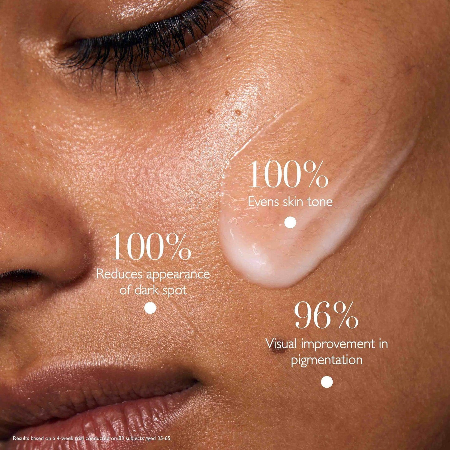 Omorovicza Hyperpigmentation Serum applied on skin, showcasing its benefits for even skin tone and dark spot reduction