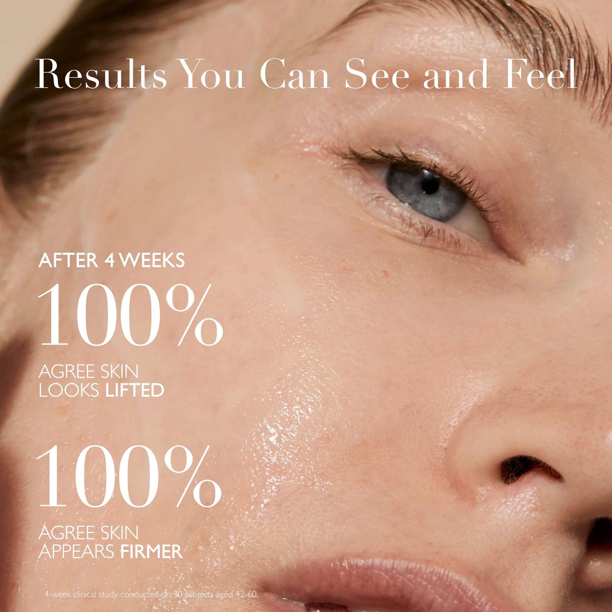 Close-up of a woman's face highlighting results of Omorovicza retinol alternative serum on lifted, firmer skin