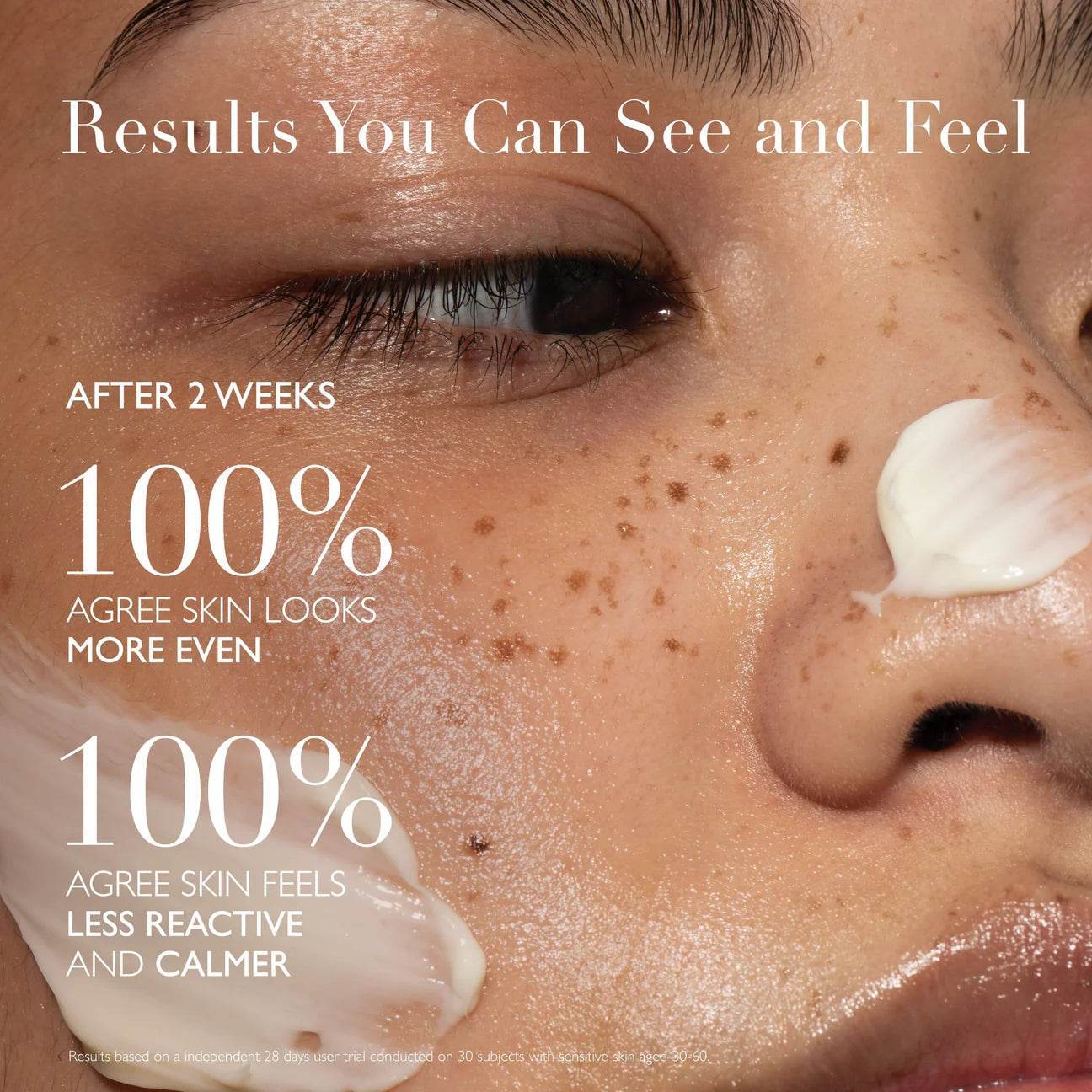 Before and after image showing results of Omorovicza Soothing Salve for even and calm skin