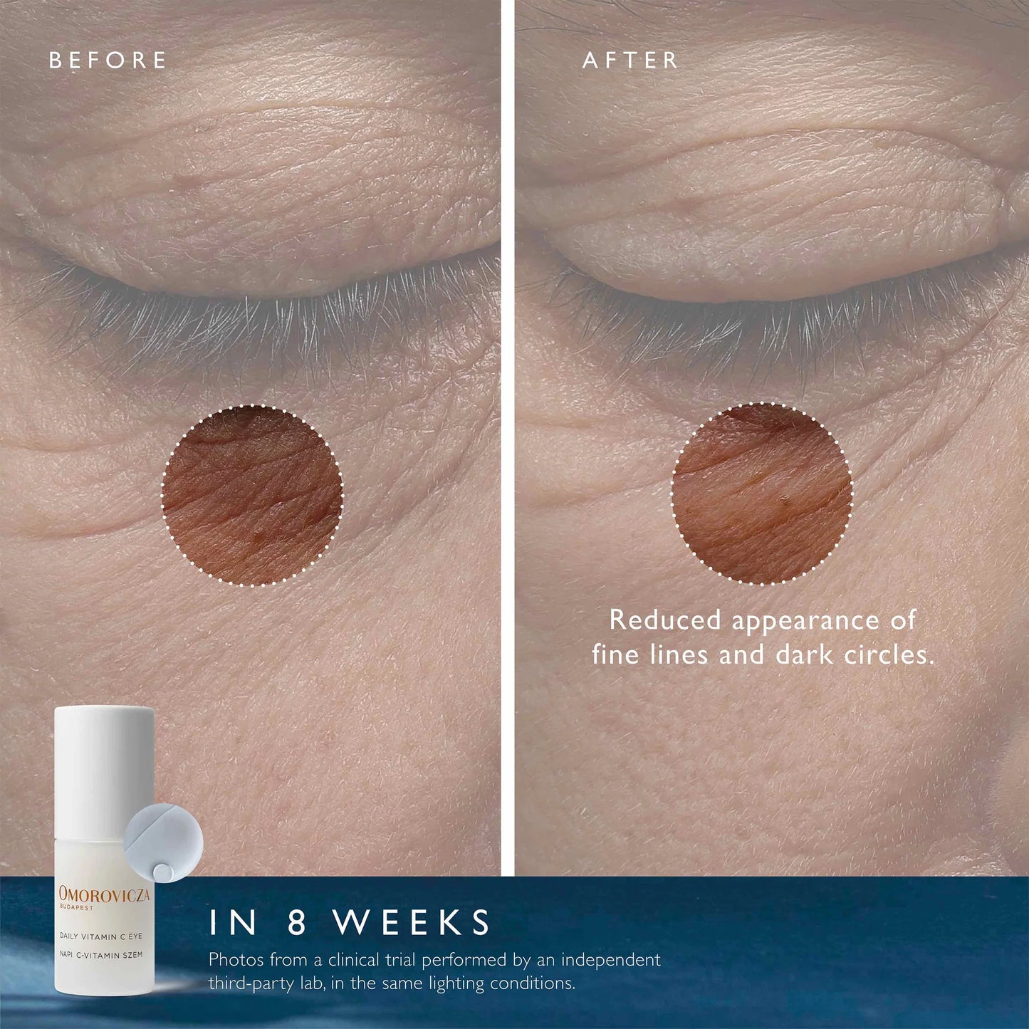 Before and after images showcasing Omorovicza Vitamin C eye cream reducing fine lines and dark circles